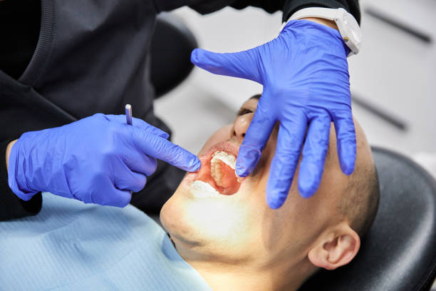 Best Emergency Root Canal Treatment in Palestine, TX